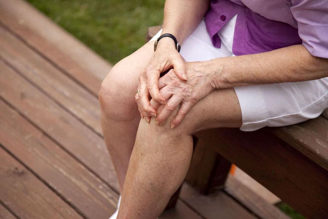 A térdízületi gyulladás gyakori az idősebb nőknél