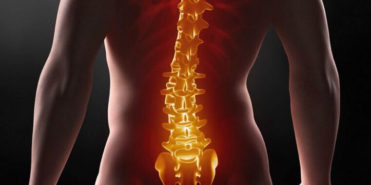 Elviselhetetlen fájdalom a hát alsó részén - az ágyéki osteochondrosis III szakaszának tünete