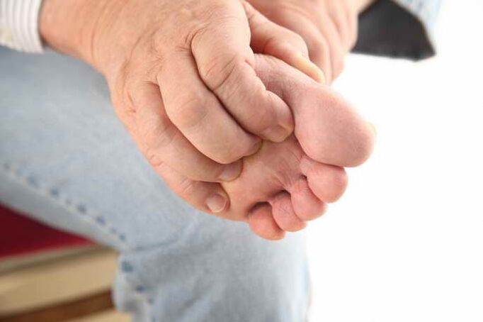 Viszketés a lábában mellkasi osteochondrosissal