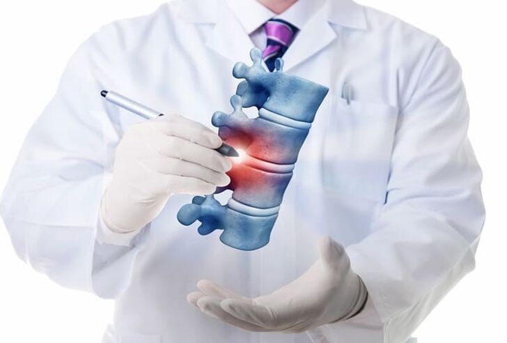 mellkasi osteochondrosis okozta gerinc elváltozások